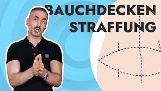 Dein Plastic Surgery Coach - Labbrige Bauchdecke? Alles über die Bauchdeckenstraffung.