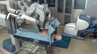 Medical Animations of Robotic Surgery