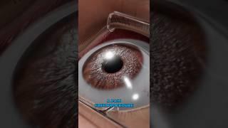 Legally blind to 20/20 in 30 minutes! (3D Animation)