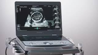 11  OBGYN Mindray MX7 Ultrasound