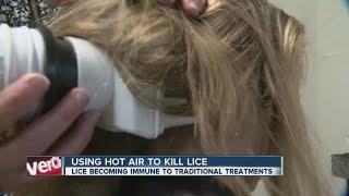 Device battles treatment-resistant lice