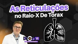 AS RETICULAÇÕES NO RAIO-X DE TÓRAX I VOCÊ RADIOLOGISTA