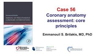 Case 56: PCI Manual - Coronary anatomy assessment: core principles