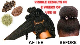 Do Not Wash Out! USE CLOVES,ROSEMARY,FLAXSEED SPRAY FOR 2 WEEKS & YOUR HAIR WILL NOT STOP GROWING