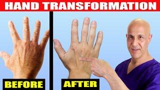 Transform Wrinkled, Dry, Aged Hands...Look Younger with This Natural Elixir!  Dr. Mandell