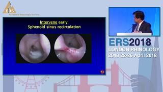 ERS London 2018, P Hwang, Office Based Rhinology