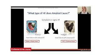 Living with Amyloidosis Professor Emer Joyce, Consultant Cardiologist, Mater University Hospital