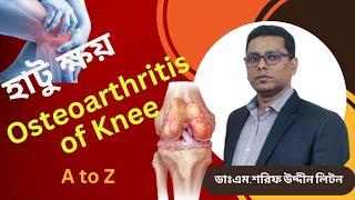 Osteoarthritis of knee||হাটু ক্ষয়||Dr.M.Sharif Uddin Liton