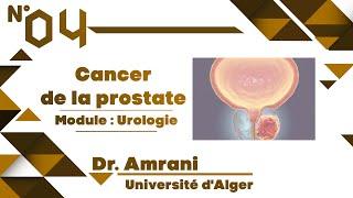 #Uro | 04. Cancer de la prostate (Dr Amrani)