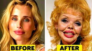 ப்ளாஸ்டிக் சர்ஜரியால் பேயாக மாறியவர்கள் | Plastic Surgery Went Horribly Wrong | Galatta Info Tamil