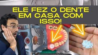 DENTISTA REAGE E TESTA NOVO MATERIAL PARA FAZER DENTE EM CASA!