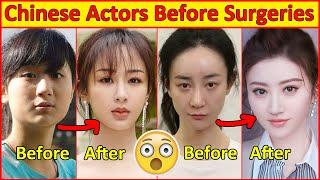 Chinese Actors Before and After Plastic Surgeries  , Incredible Changes, Chinese Drama