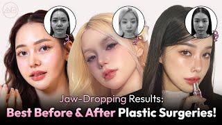 Top 3 Models Who Nailed Plastic Surgery | AB Plastic Surgery Korea