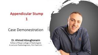 | GIT | Acute abdomen | Appendicular stump & Ruptured ovarian cyst |