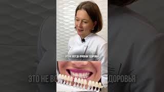 ЗДОРОВЫЕ ЗУБЫ НЕ ВСЕГДА БЕЛЫЕ!! могут быть и желтыми   #здоровыелюди #зубы #стоматология #интересно