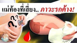 อาการคนท้อง : แม่ท้องที่เสี่ยงรกค้างหลังคลอด | รกค้าง | คนท้อง Everything