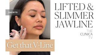 For a more lifted and slimmer jawline | Botox Injection Procedure | #shorts