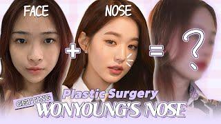 Getting Rhinoplasty at NANA Hospital to Look Like Ive's Wonyoung