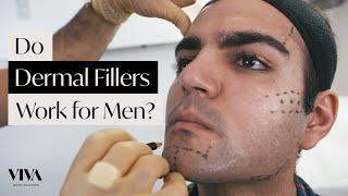 Do Men's Dermal Fillers Really Work?  How to fine-tune Points of Masculinity