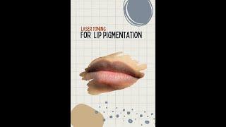 laser toning for lip pigmentation #shorts #darklips