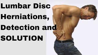 How to fix a herniated disc in the lumbar spine