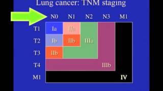 UCSF Radiology: What Does Diagnostic Imaging and Staging Tell Us?