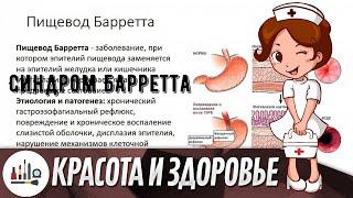 Синдром Барретта