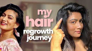 REGROW your hair after c*vid || Tips & Tricks that actually work || Ashtrixx