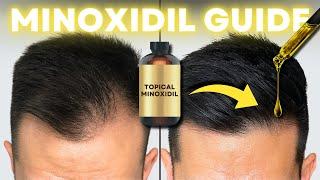 How to Regrow Hair Using Minoxidil: Step-by-Step Guide | AL GARRIDO