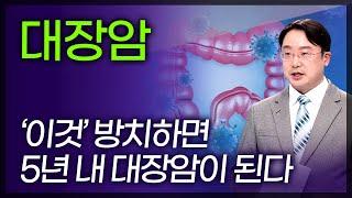 대장암의 씨앗 '이것' 성인 3명 중 1명에 나타나는 아주 흔한 질병이지만 종류에 따라 암으로 발전한다 [ TV닥터인사이드 ] 161218