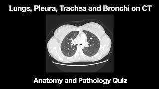 The Lungs, Pleura, Trachea and Bronchi Anatomy and Pathology Quiz