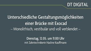 Unterschiedliche Gestaltungsmöglichkeiten einer Brücke mit Exocad