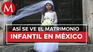 Gravedad del fenómeno del matrimonio infantil en México