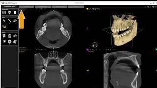 CS 3D imaging software basic tutorial #Carestream