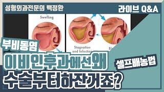 왜 부비동염 배농법은 이비인후과에서 말해주지 않는걸까요?