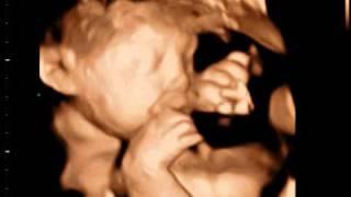 Baby 32 Weeks - 3D Ultrasound video - 3D Sono Image