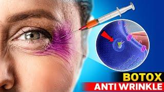 How Botox Works | How Does Botulinum Toxin Work? Botox lasts how long