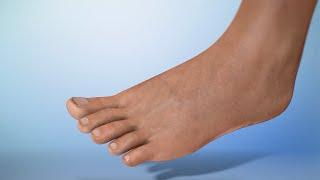 How to Take Care of your Feet If You Have Diabetes
