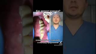 Как делают коронки?Ч.3 #стоматолог #стоматология #протезированиезубов #коронканазуб #металлокерамика