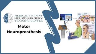 Motor Neuroprosthesis