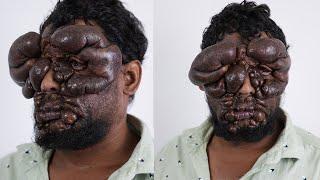 Help Ravikumar Get A New Face