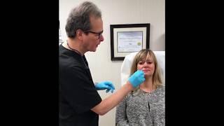 Volbella Injection at Maryland Dermatology Laser Skin & Vein Institue