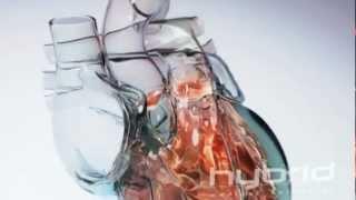 Glass Heart Hybrid Medical Animation HD