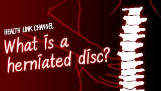 What is Herniated Disc?