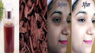 Ratanjot Face toner to get rid of Dark, Dull & Damaged Skin | Ratanjot Face Toner for Glowing Skin