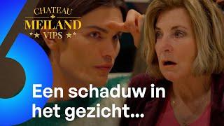 OMG! Koen Pieter heeft zijn VOORHOOFD WEG LATEN ZAGEN!  | Chateau Meiland VIPS