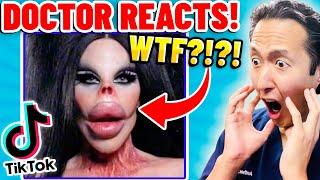 Plastic Surgeon Reacts to BOTCHED Plastic Surgery TikTok Videos!