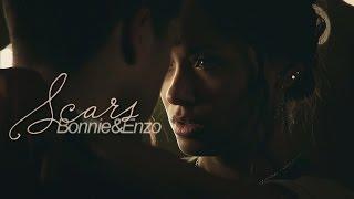 Bonnie & Enzo | Scars