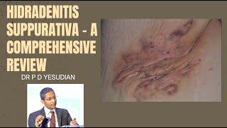 Hidradenitis suppurativa - a comprehensive review of all treatments