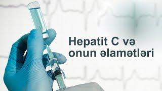 Hepatit C və onun əlamətləri - Qastroenteroloq - Emin Verdiyev